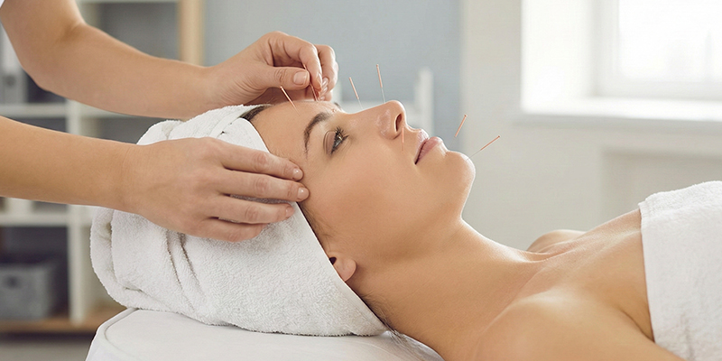 Acupuntura Médica