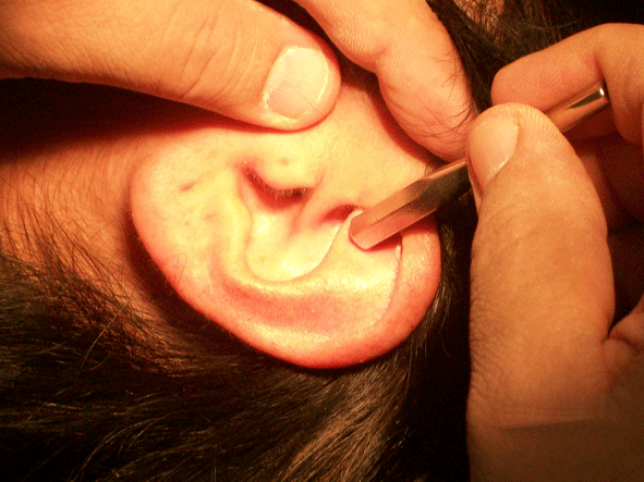 Aplicación Tachuelas