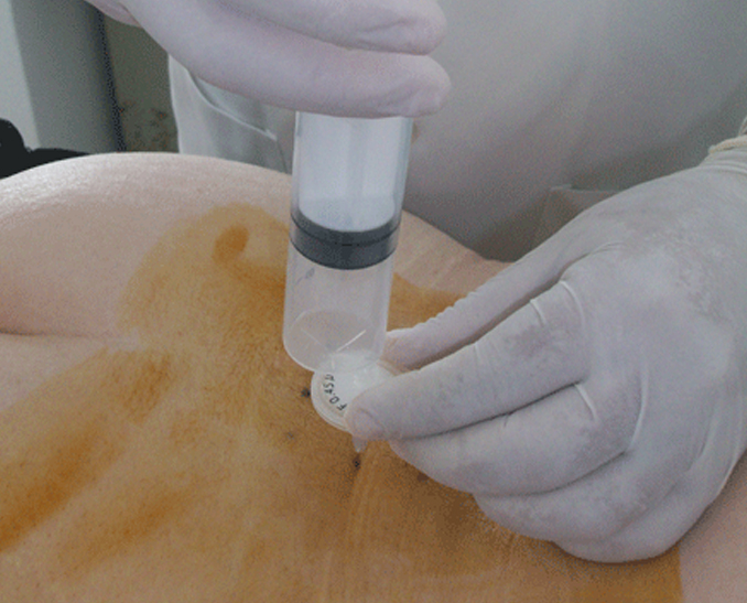 Clínica Bioenergética Alemán